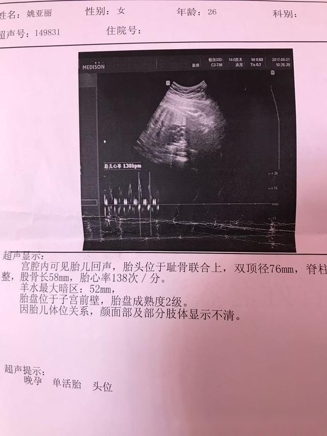 生双胞胎男孩秘诀偏方_男孩尿床偏方大全红枣_生男孩的偏方