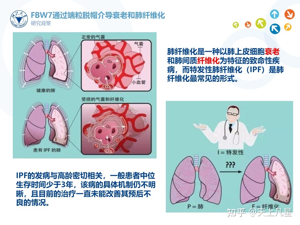 肺纤维,增殖灶_肺纤维化的偏方治疗_黄成义肺纤维