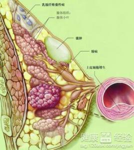 site256shop.com 乳腺纤维细瘤会复发吗_纤维瘤要敷秘方_泡泡面膜敷完要敷补水面膜吗