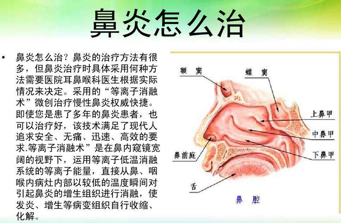 慢性干燥鼻炎偏方_慢性鼻炎治疗偏方_慢性单纯性鼻炎怎么治疗