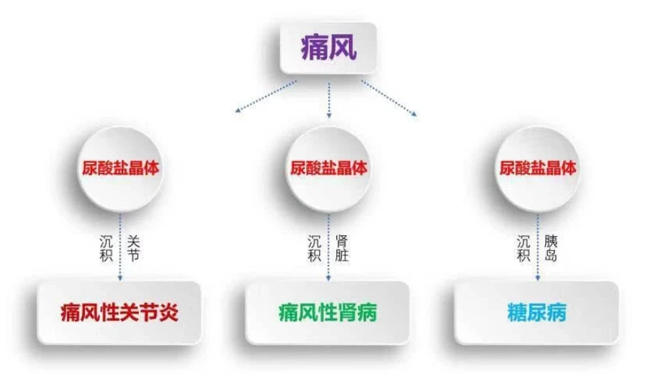 甘油三酯高 尿酸高_尿酸高吃什么降尿酸_尿酸高秘方