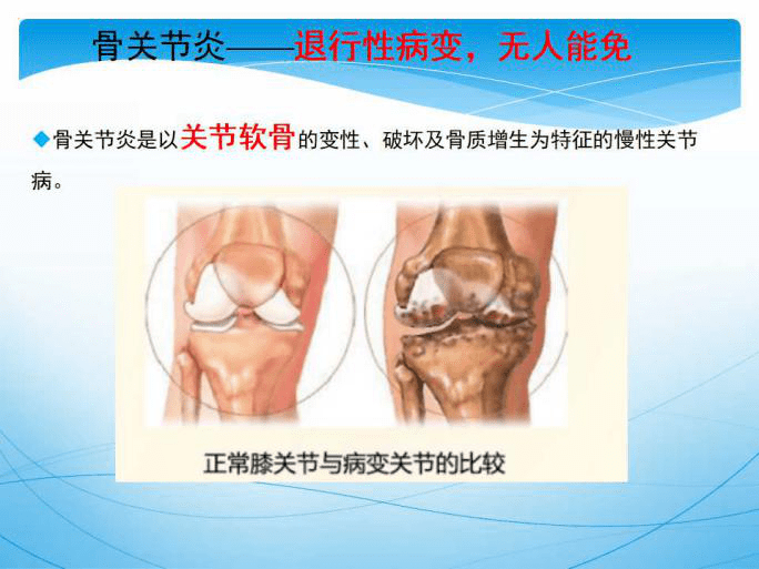 治疗类风湿关节炎的偏方_支气管炎和支原体炎治疗偏方_治疗关节炎偏方