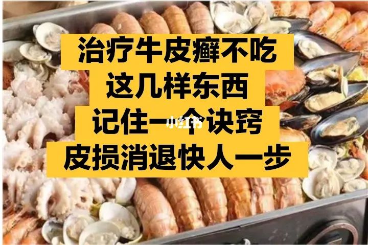 民间紫癜病偏方_银屑病偏方_偏方治癫病绝招