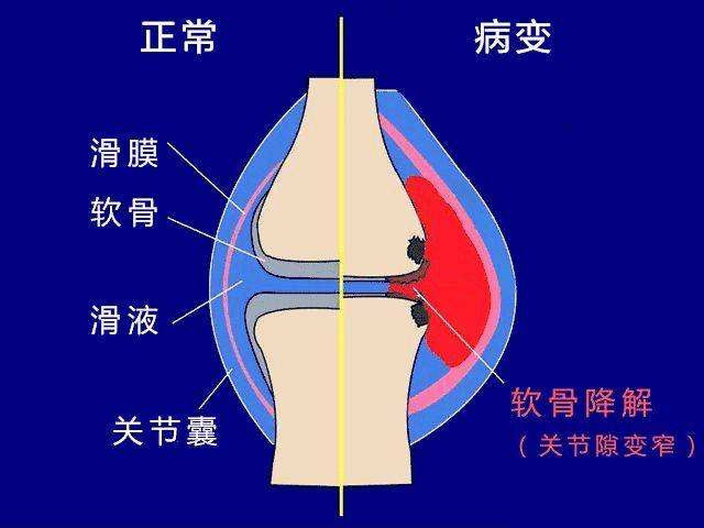 治疗坐骨神经痛的秘方_神经阻滞技术治疗带状疱疹后遗神经痛的不良反应是什么_21个治疗烧烫伤秘方 家传秘方