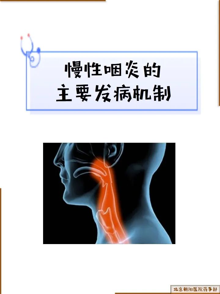 土方治慢性咽喉炎_咽h喉炎犯了可以吃鱼吗_慢性肥厚性咽炎的偏方