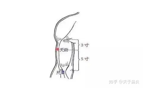 鼻炎治疗偏方_鼻炎偏方最佳治疗_治疗鼻炎的小偏方