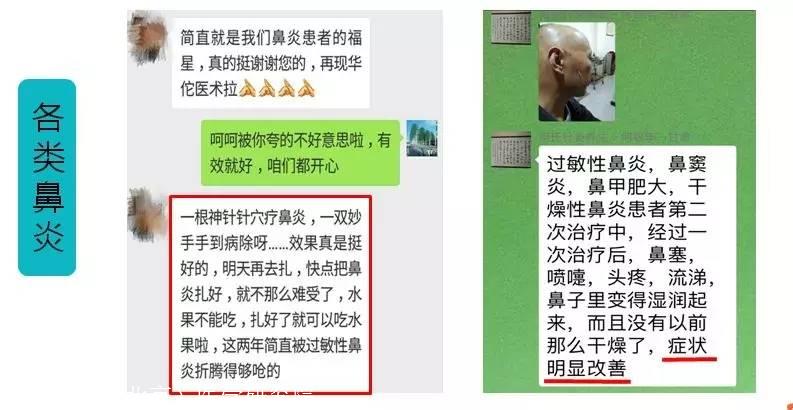 治疗鼻炎的小偏方_鼻炎偏方鼻炎粉_鼻炎咽炎一起发作有没有偏方治疗