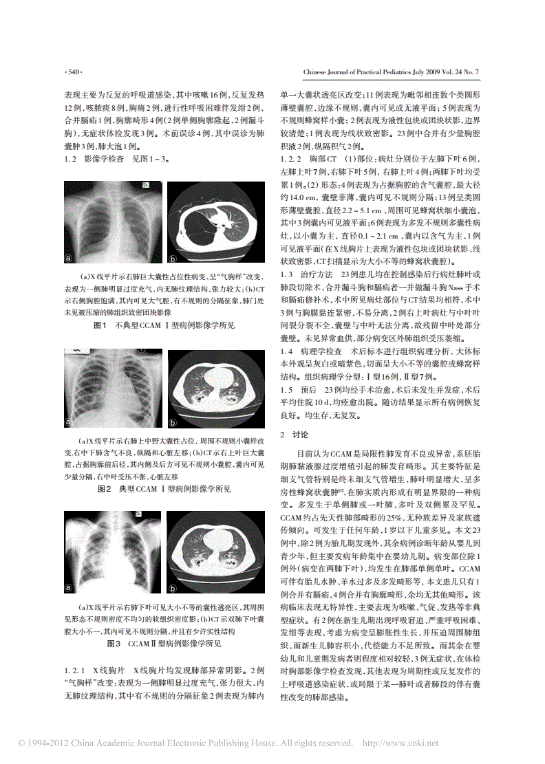 肺纤维化的偏方治疗_治疗肺积水的偏方_肺纤维化的偏方治疗