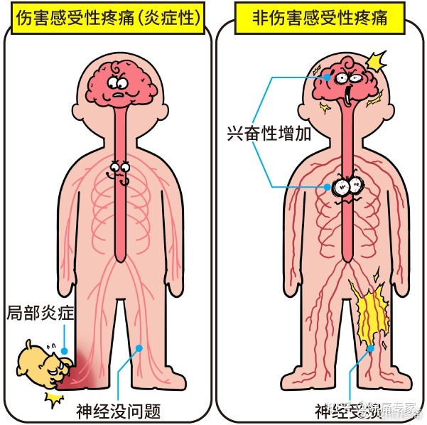 治疗腰椎骨质增生症_那里治疗骨质增生好_治疗骨质增生的偏方