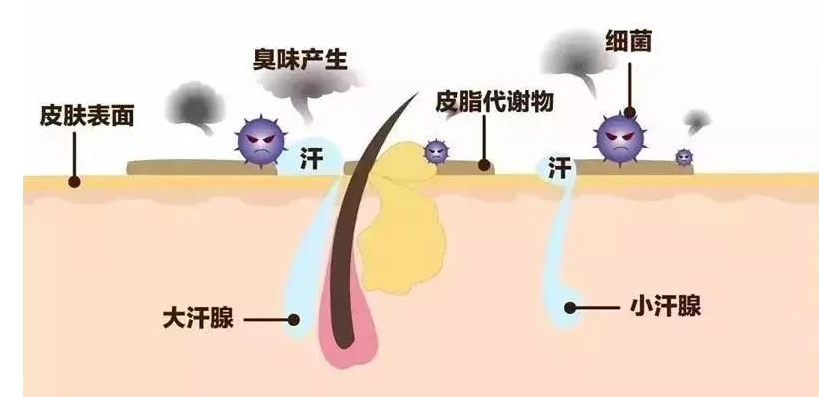 明荃狐臭净治疗狐臭_如何治疗狐臭 民间治疗狐臭的方法_治疗狐臭的偏方