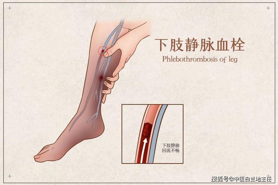 腰腿神经性痛疼怎么办_经方特效腰腿痛方_香港必理痛特效副作用