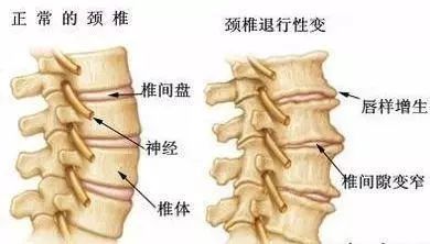 中医中药秘方偏方大全_颈椎病有效偏方秘方_乳腺纤维瘤有效秘方偏方