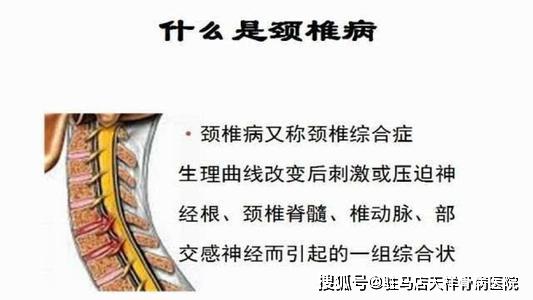 中医中药秘方偏方大全_乳腺纤维瘤有效秘方偏方_颈椎病有效偏方秘方