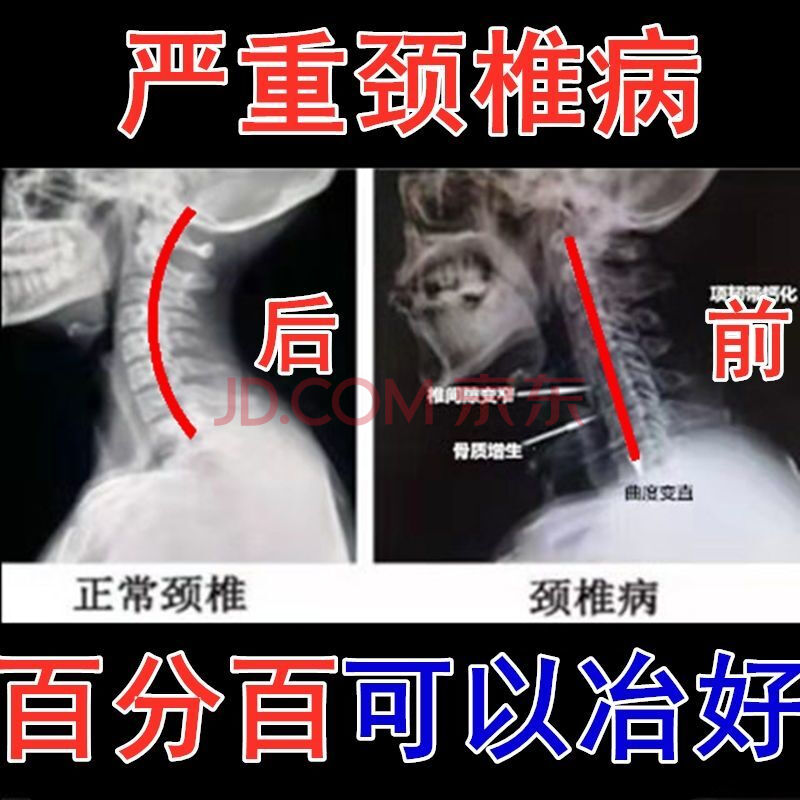 乳腺纤维瘤有效秘方偏方_颈椎病有效偏方秘方_丰胸秘方偏方大全