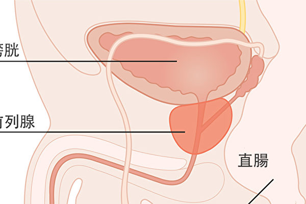 中医灵药奇方治疗前列腺肥大