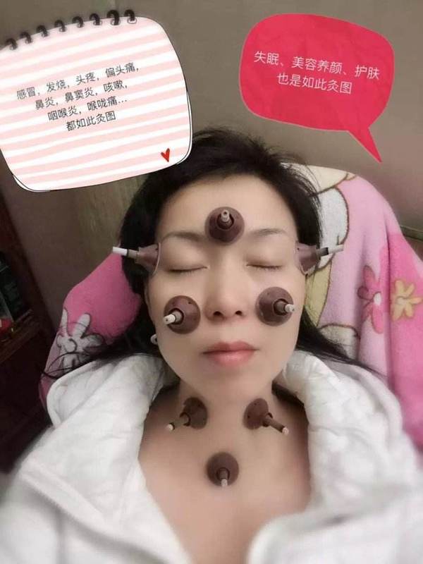 有淡奶油可以做什么小吃_可以淡斑的偏方有哪些_遗传斑怎么淡化小妙招