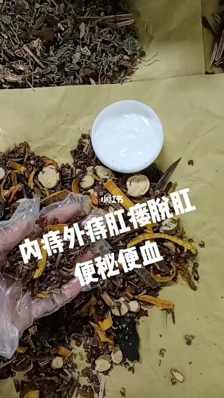 治痔疮偏方大全_治痔疮偏方绝招_治痔疮偏方