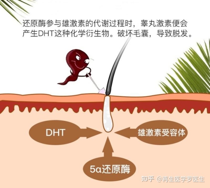 脂溢性脱发偏方_脂溢脱发原因及治疗_脂溢脱发原因