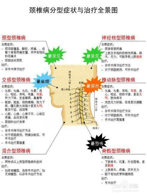 治疗颈椎病的偏方_颈椎病的最佳治疗偏方_颈椎病的治疗偏方