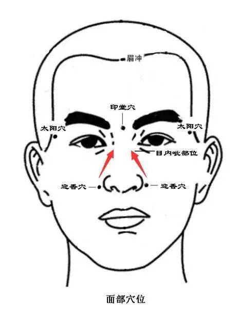 鼻炎秘方