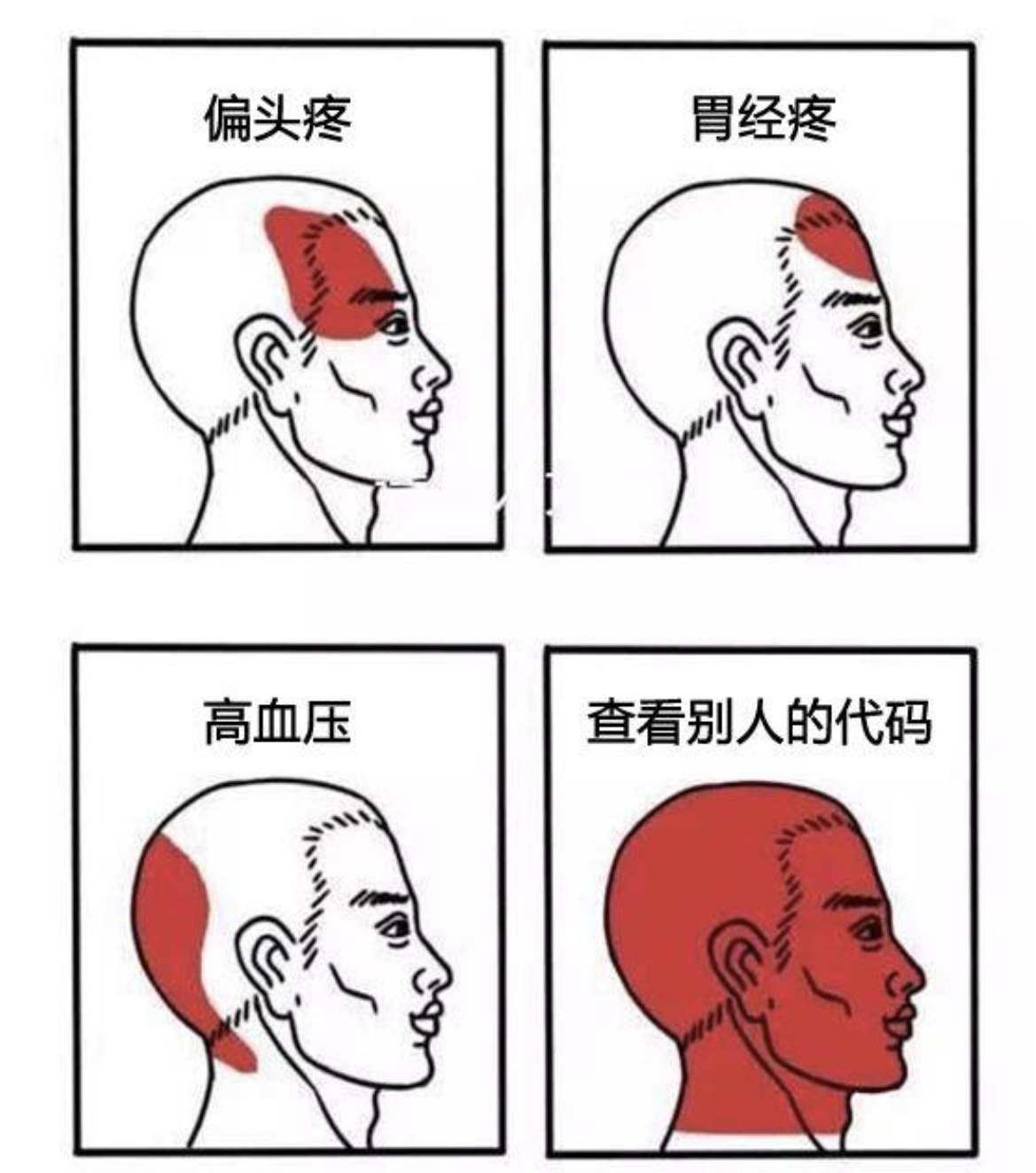 偏头疼治疗偏方