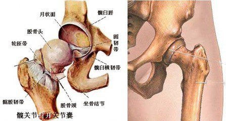 治疗股骨头坏死秘方_骨头坏死 治疗_胡骨头坏死怎么治疗