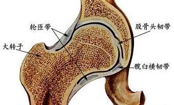 胡骨头坏死怎么治疗_治疗股骨头坏死秘方_骨头坏死 治疗