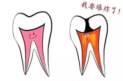 牙疼不会要命，用偏方才会