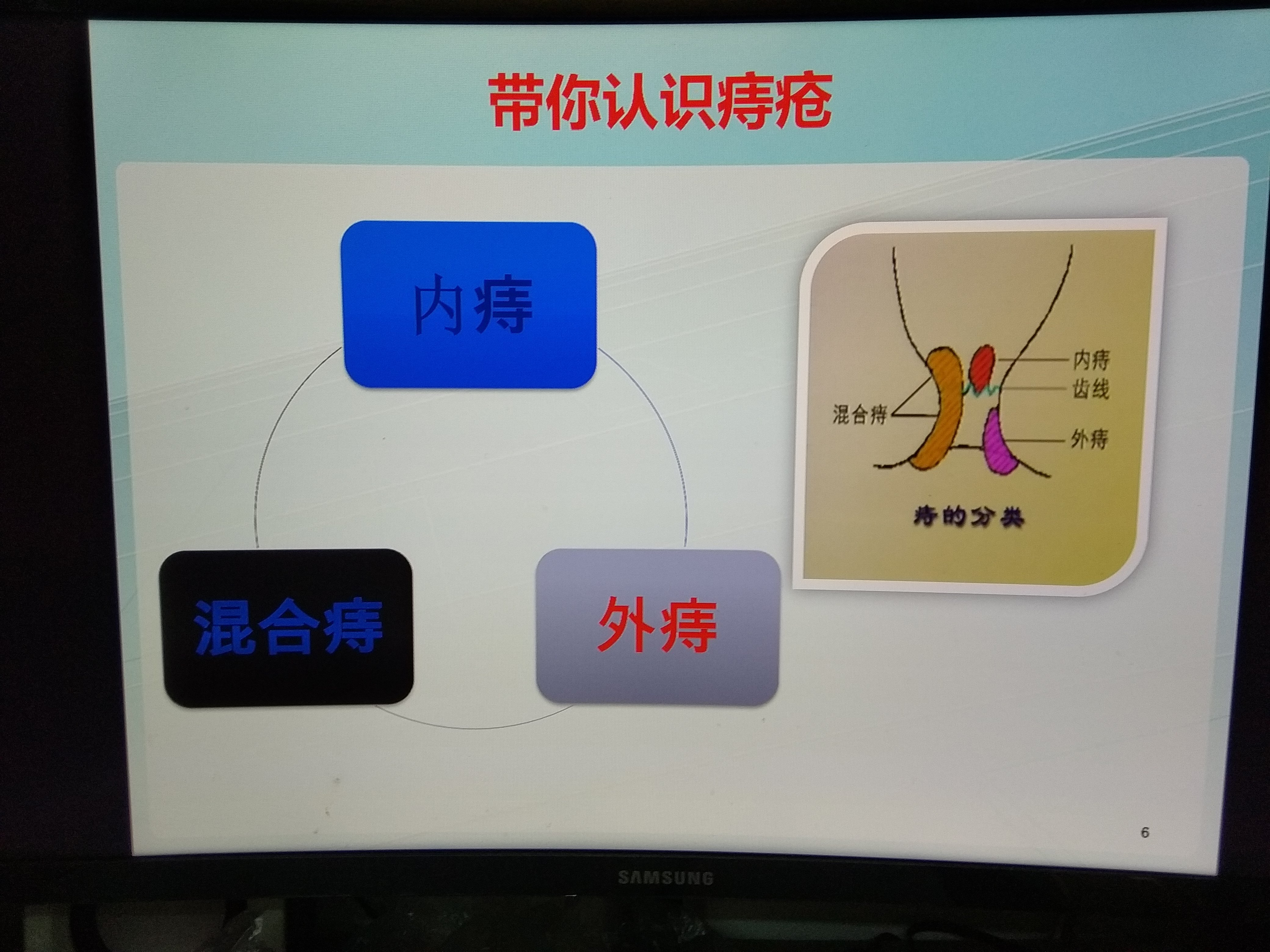 柿饼治痔疮的偏方_小偏方治痔疮_民间治痔疮的偏方