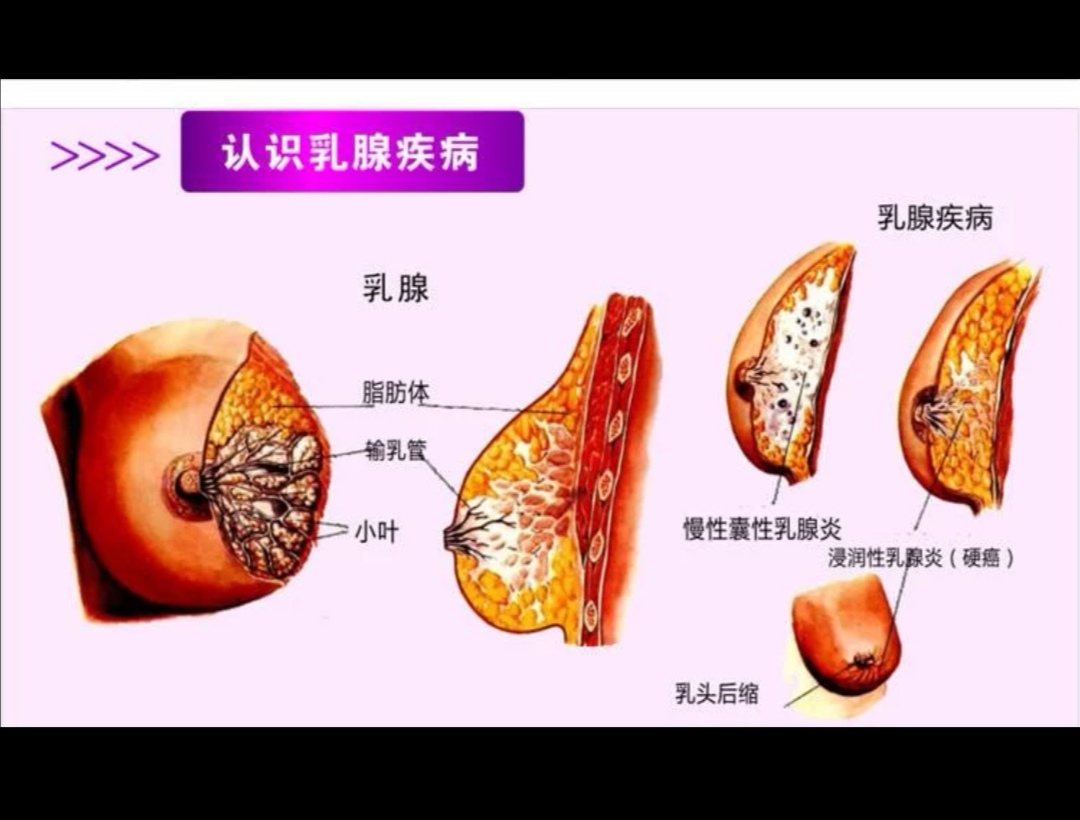 乳腺增生有什么偏方可以根治_增生性贫血可以根治吗_site256shop.com 乳腺的增生可以吃虫草吗