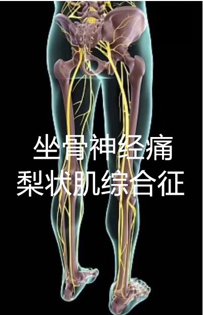 腰椎健盘突出怎么治疗_腰椎突出中药泡酒秘方大全_神奇膏药秘方治腰椎间盘突出