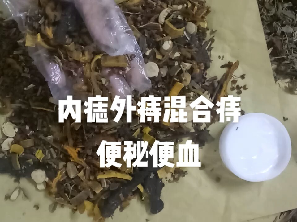 痔疮偏方_治疗痔疮最有效的偏方_痔疮中药偏方