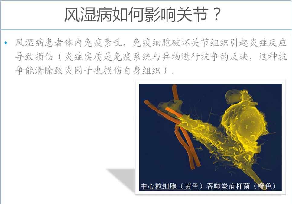 风湿麻木治疗偏方_风湿病偏方_内风湿偏方