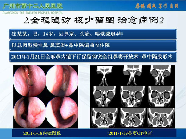 慢性前列腺炎治疗偏方_治疗过敏鼻炎偏方_慢性鼻炎治疗偏方