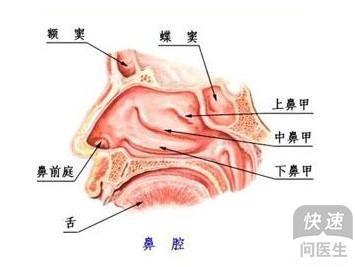 (3)封闭疗法:鼻丘闭封或下鼻甲黏膜下封闭
