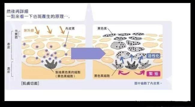 祛肝斑中药_肝斑中药祛斑秘方_中药调理祛肝斑