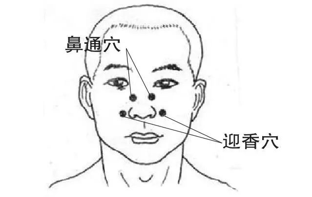 季节性鼻炎偏方_儿童鼻炎偏方_儿童鼻炎治疗偏方