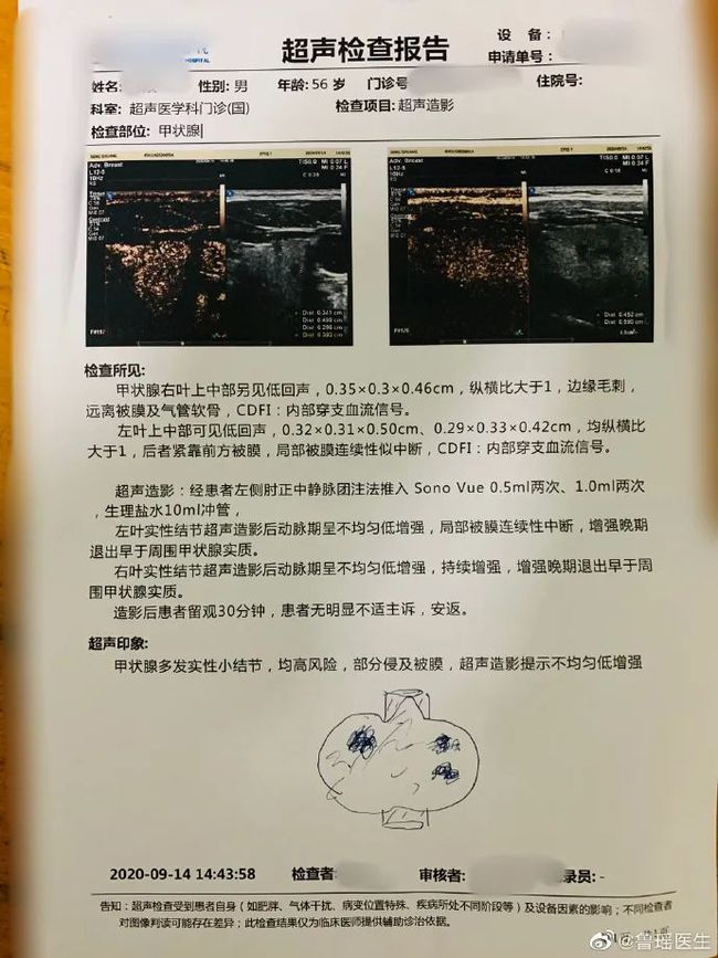 祖传根治高血压秘方_祖传甲状腺结节特效根治秘方偏方_祖传痔疮根治绝秘方