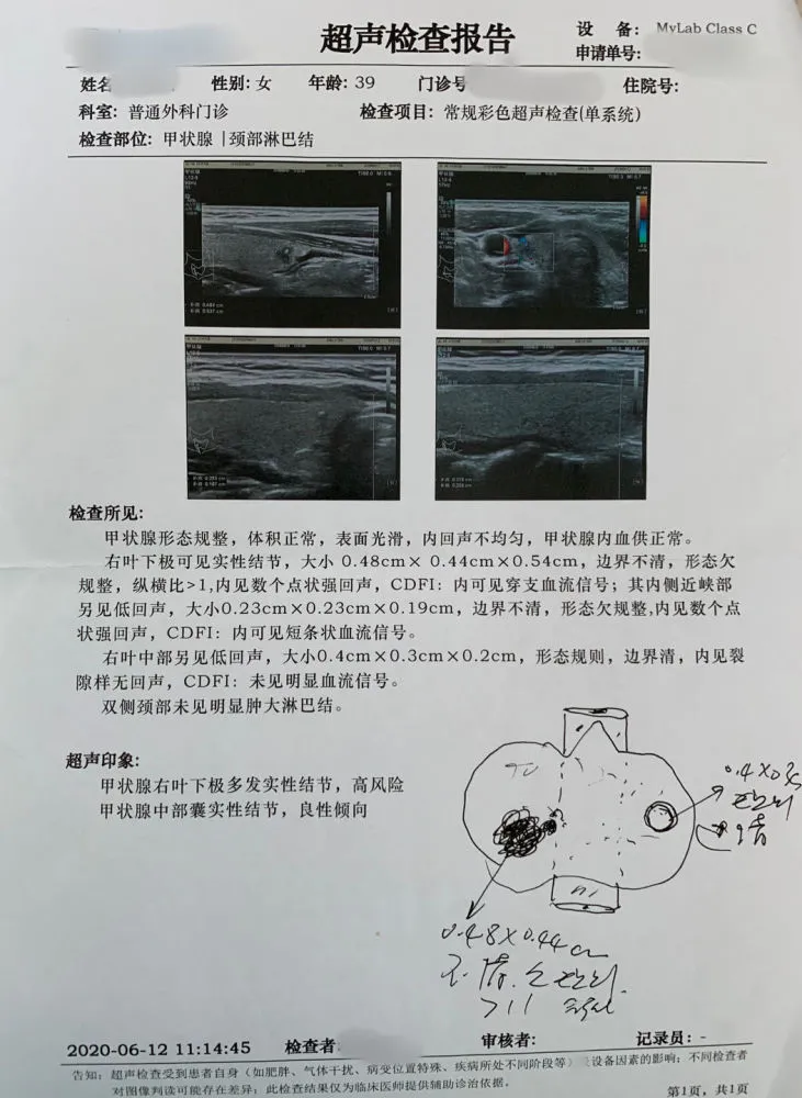 祖传甲状腺结节特效根治秘方偏方_祖传痔疮根治绝秘方_祖传根治高血压秘方