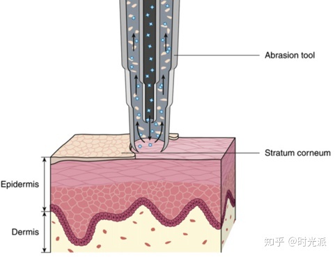 老年宇智波斑是谁_外敷治疗斑秃的偏方_去老年斑偏方