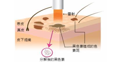 这3种去痘疤的方法有效！想祛痘不留疤就看这篇