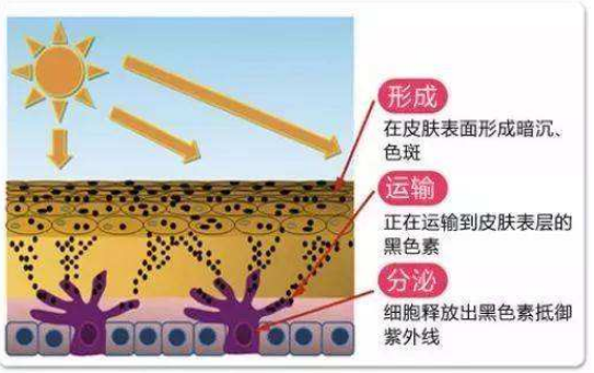 这3种去痘疤的方法有效！想祛痘不留疤就看这篇