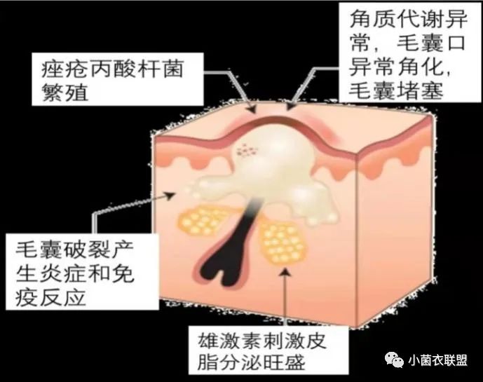 最古老治痘痘的偏方_皮肤偏方能治痘痘吗_猪油治皮肤干裂的偏方