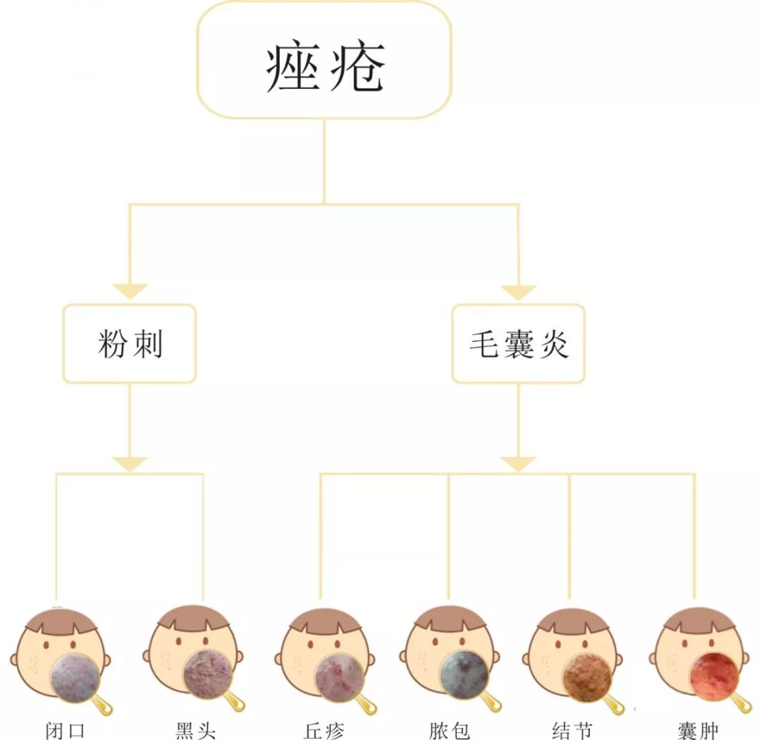 祛痘印的小窍门 6个偏方安全抹_祛痘的偏方_祛痘的偏方