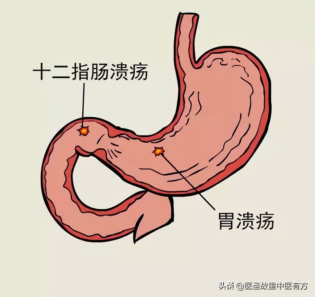 脾胃调百病消，中药名方小建中汤，缓解疲劳，增强食欲，赶走疼痛