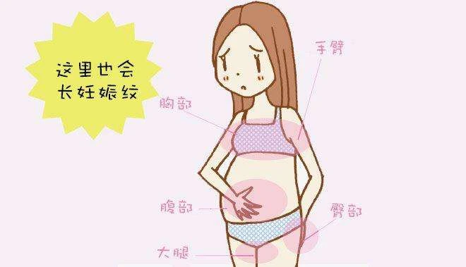 去妊娠纹偏方_妊娠纹偏方_舒纹去妊娠纹