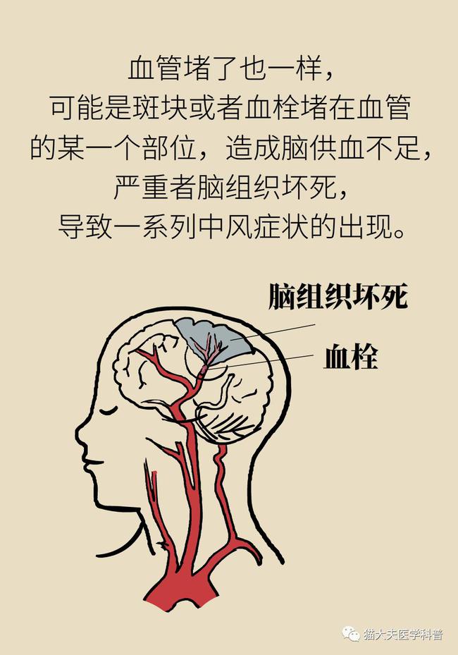 民间秘方 治疗腰椎间盘突出症的秘方_颈椎病引起的头晕头痛怎么治疗_治疗偏头痛的秘方