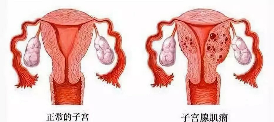 老偏方治慢性咽炎_老偏方治一型糖尿病_治月经不走的老偏方