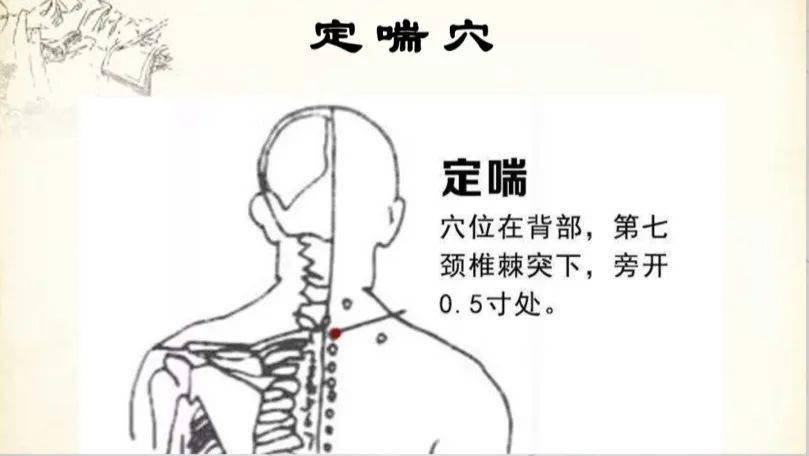 姜片止咳最快的偏方_含姜片为什么能止咳_扁平疣的醋姜片偏方