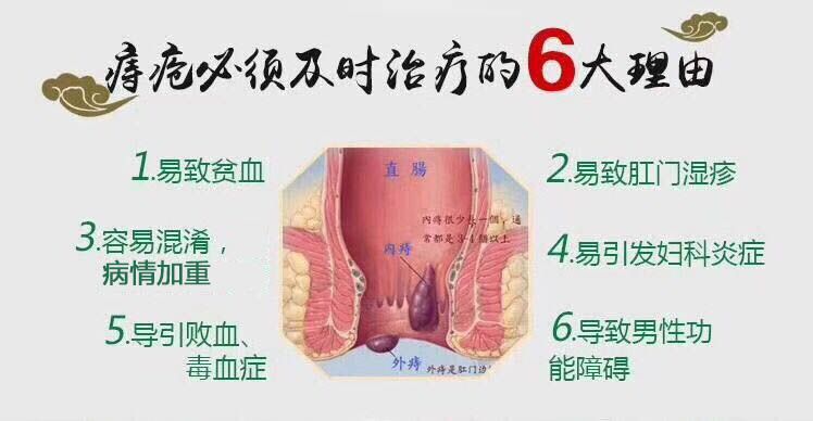 痔疮的偏方_痔疮的偏方_偏方治痔疮